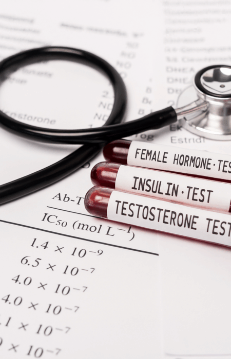 mit Myo Inositol Testosteron senken